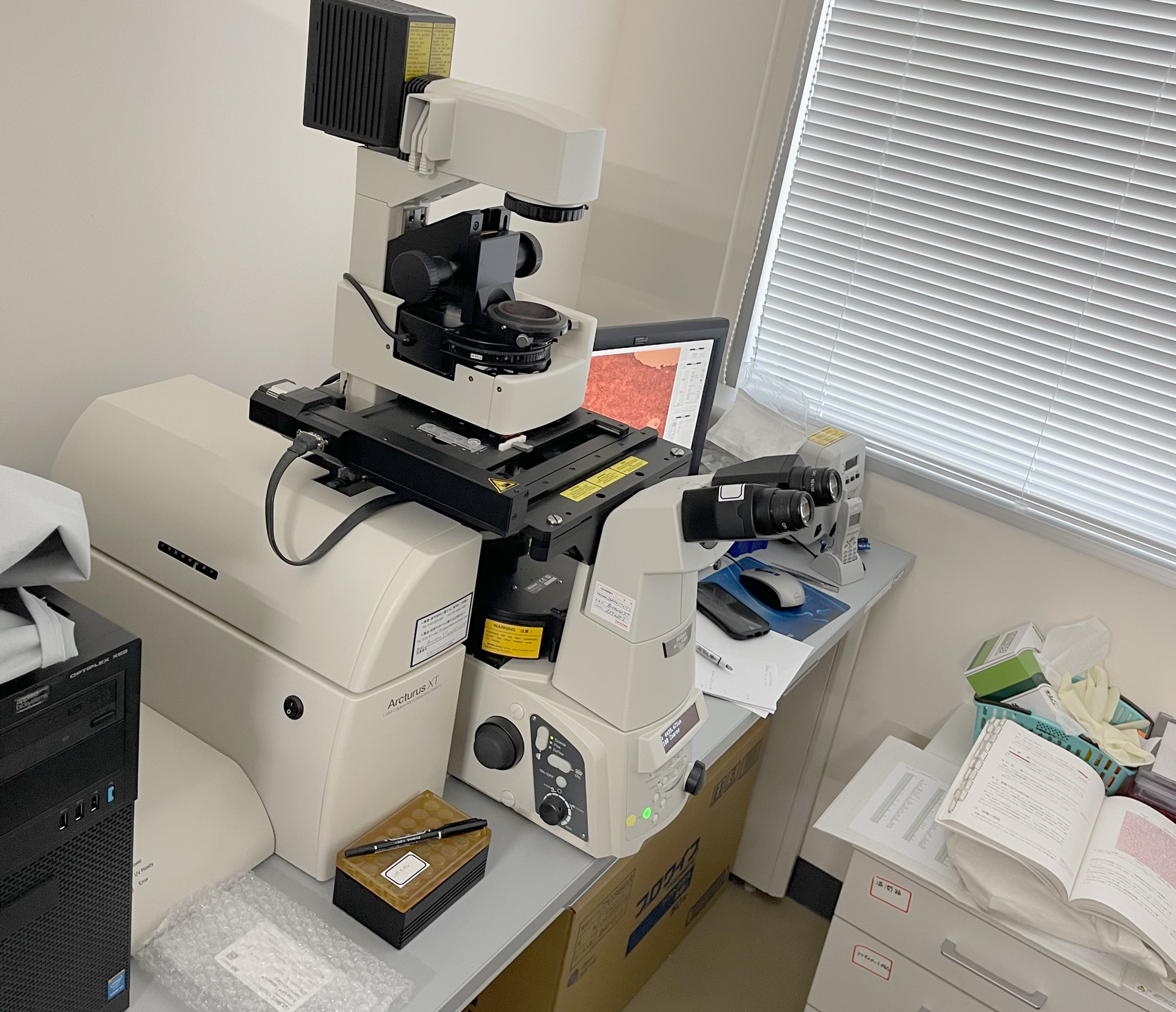 Reading the Deeper Disease State of Diabetes from Blood